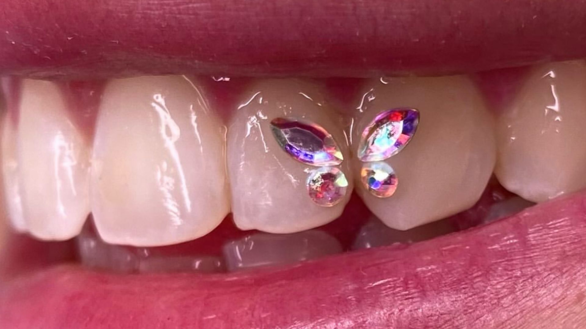 Sonrisa con tooth gems en forma de mariposa
